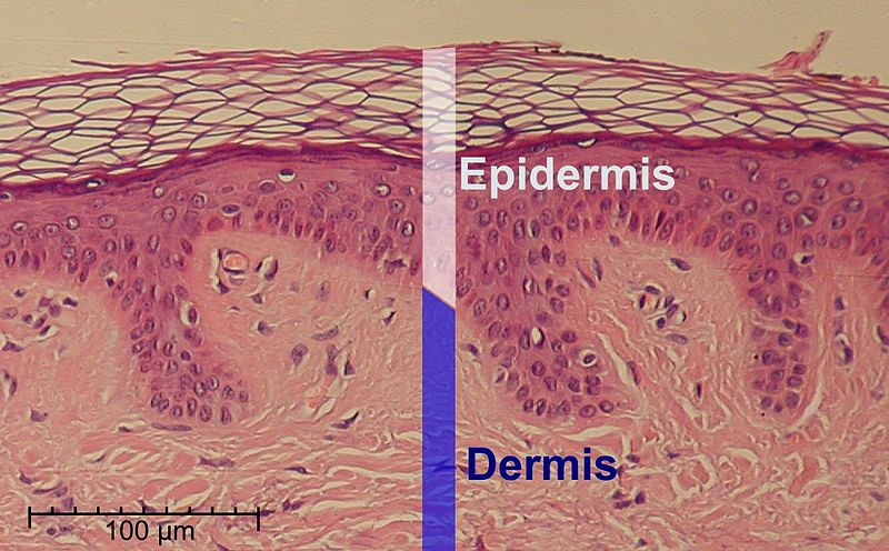 Illustration for article titled The Wrong Drug Reaction Could Literally Make Your Skin Peel Off